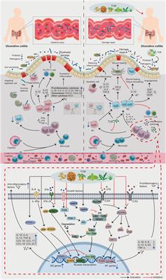 A potential therapeutic target in traditional Chinese medicine for ulcerative colitis: Macrophage polarization